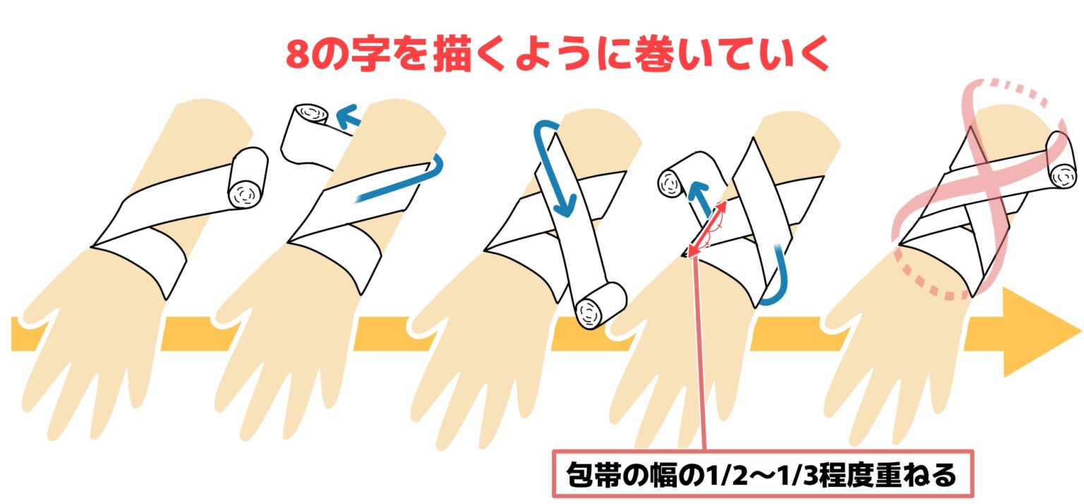これでずれない！包帯を巻くポイント - ケアのあるある知恵袋