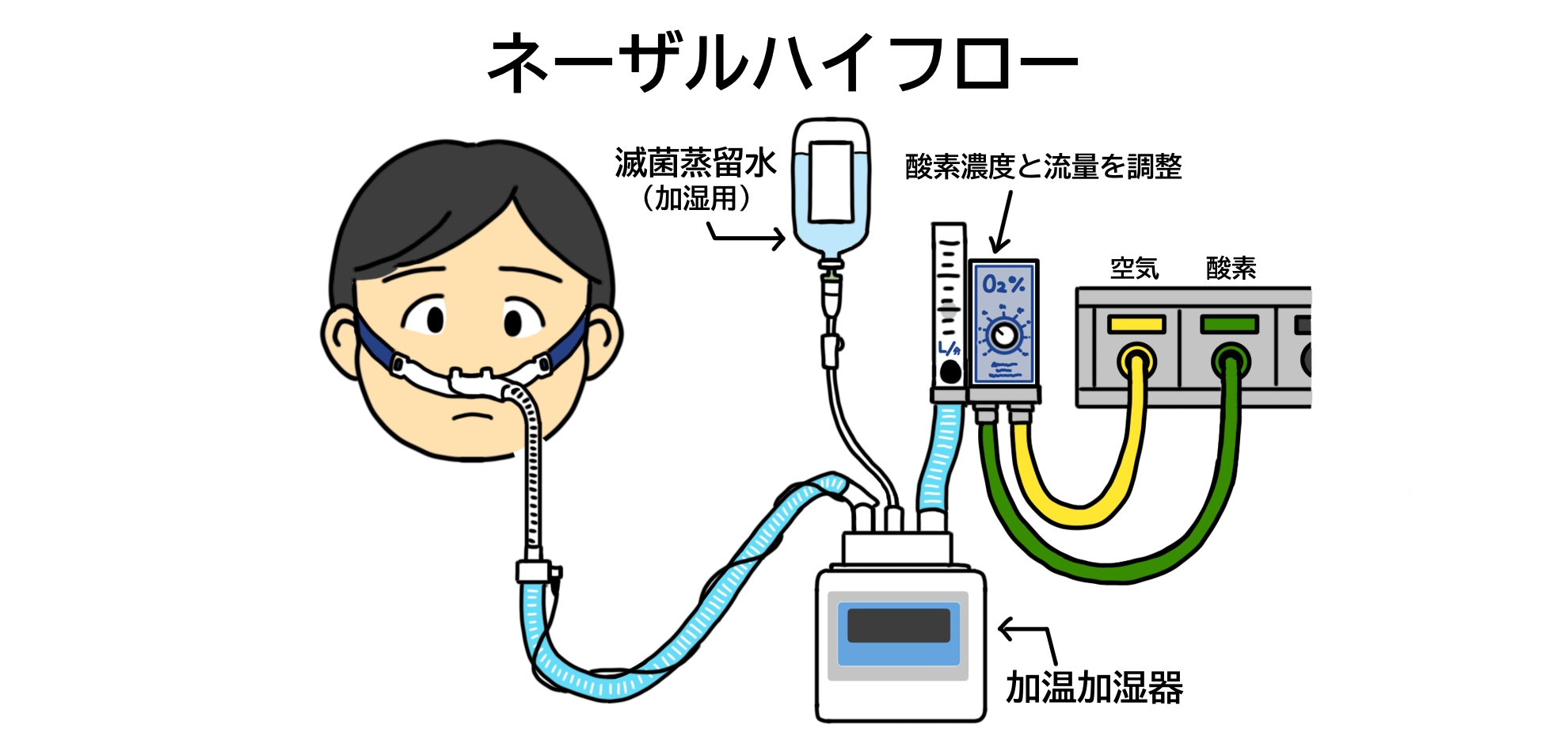 ネーザルハイフローとは？看護のポイント