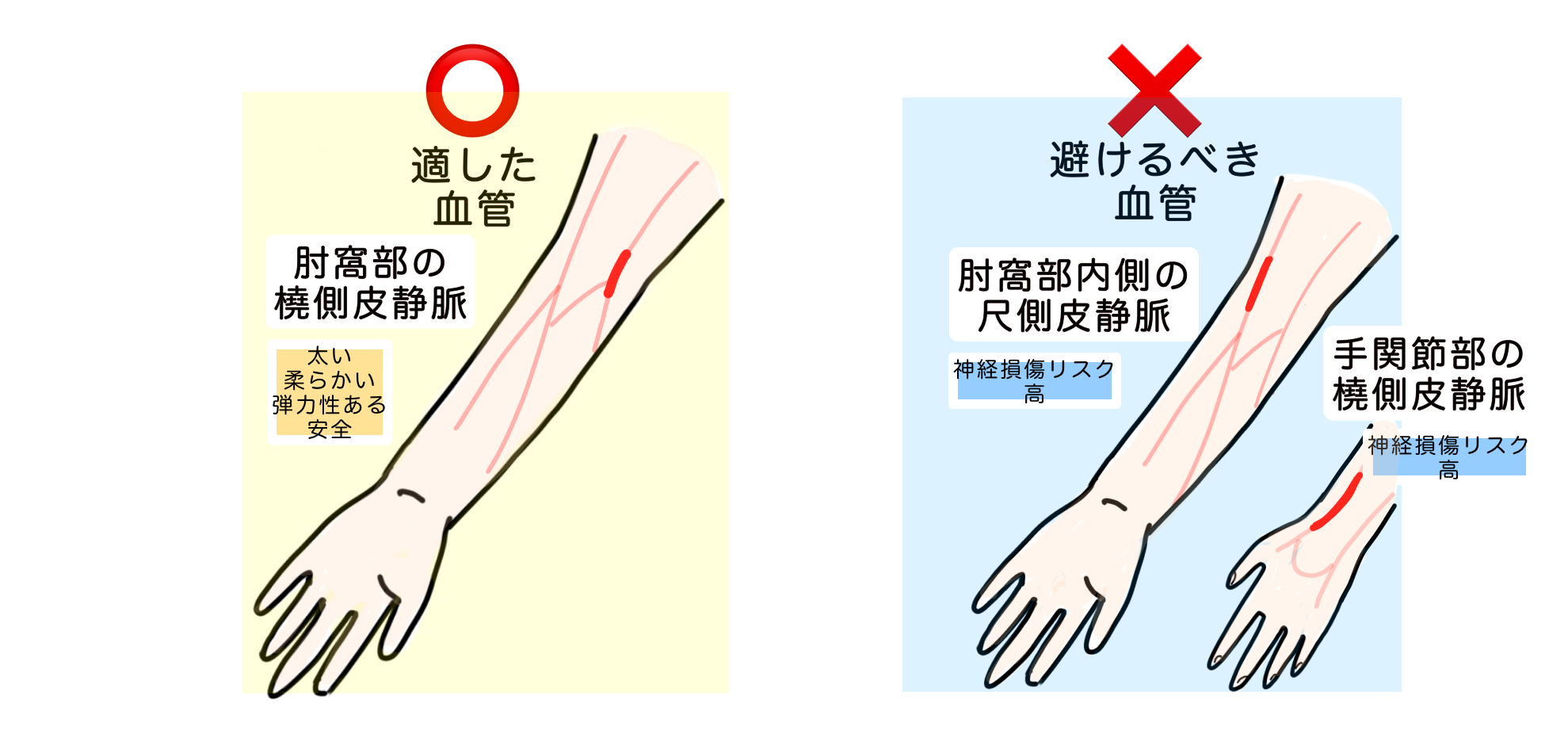 採血の血管が見えにくい原因②皮下脂肪が厚い場合