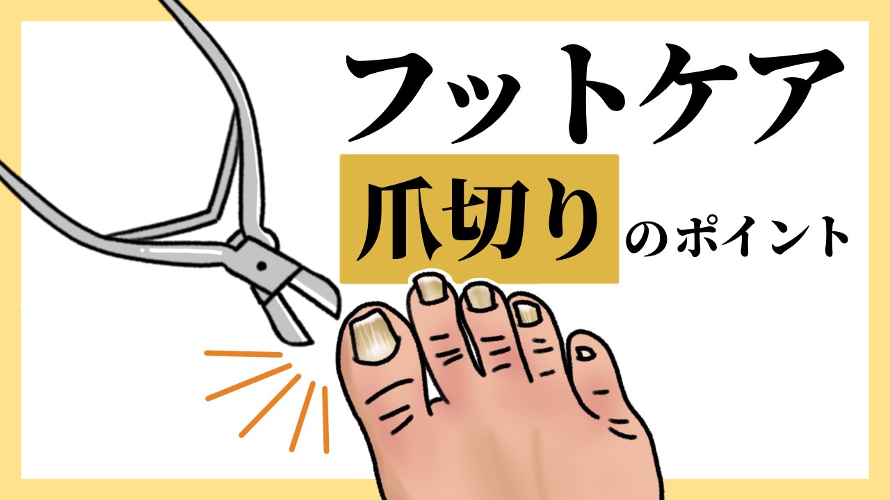 フットケア爪切りのポイント