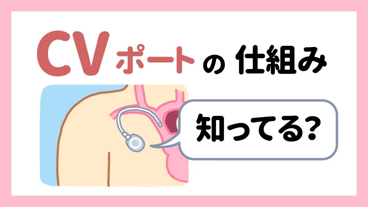 CVポートの仕組み知ってる？ちゃんと説明できる？CVポートの仕組みとタイプをおさらい