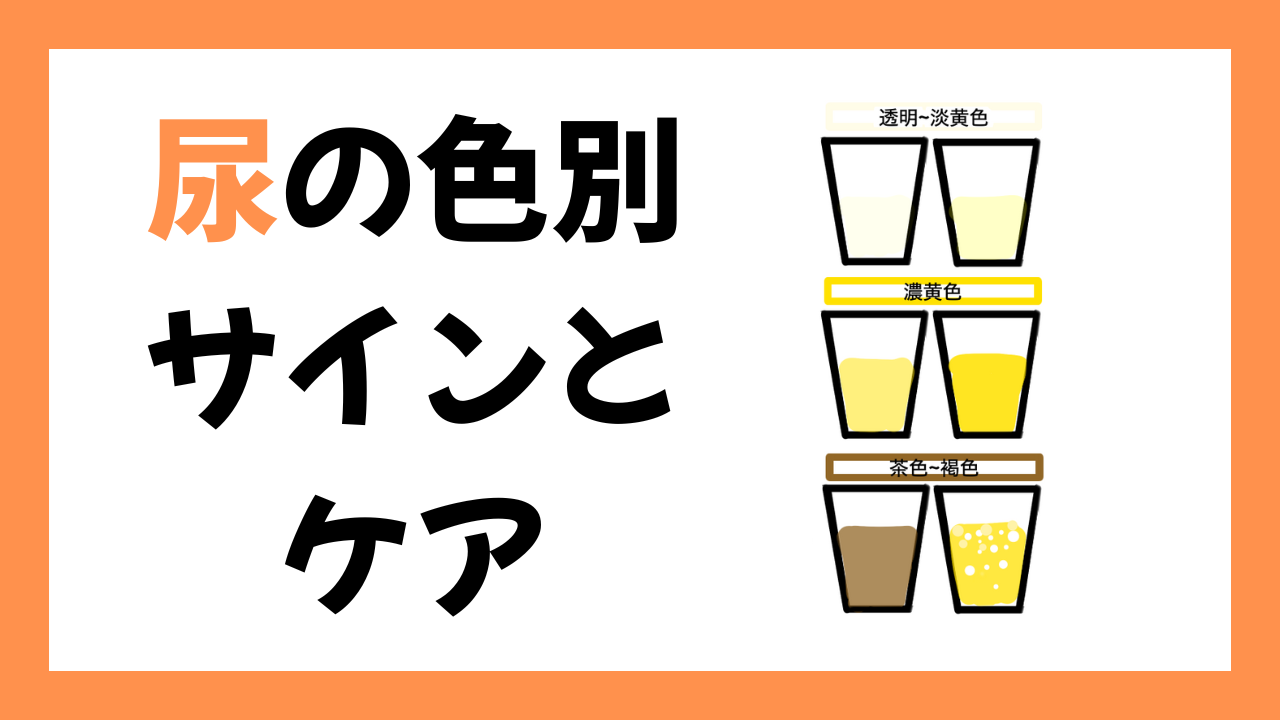尿の色、ちゃんと見てる？“色別サイン”と今すぐ活かせるケアの視点