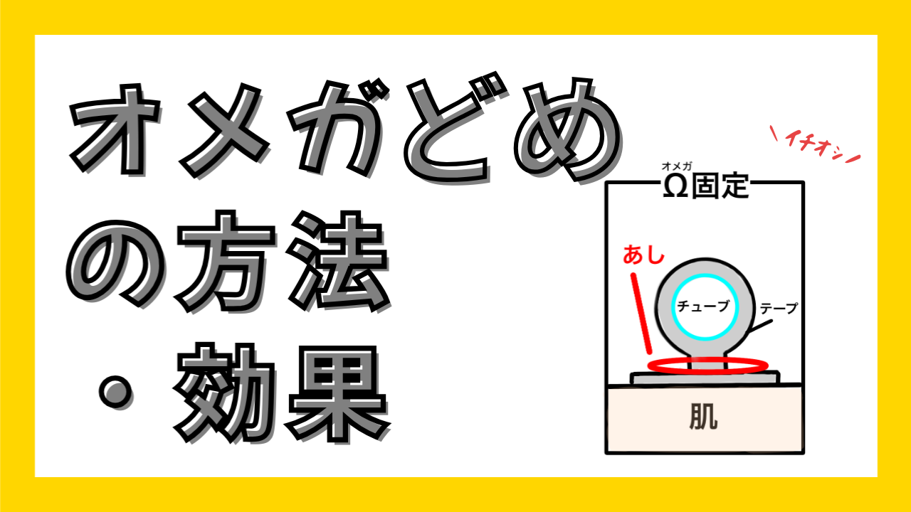 それ、ほんとに固定できてる？“Ω”がカギのオメガどめ！