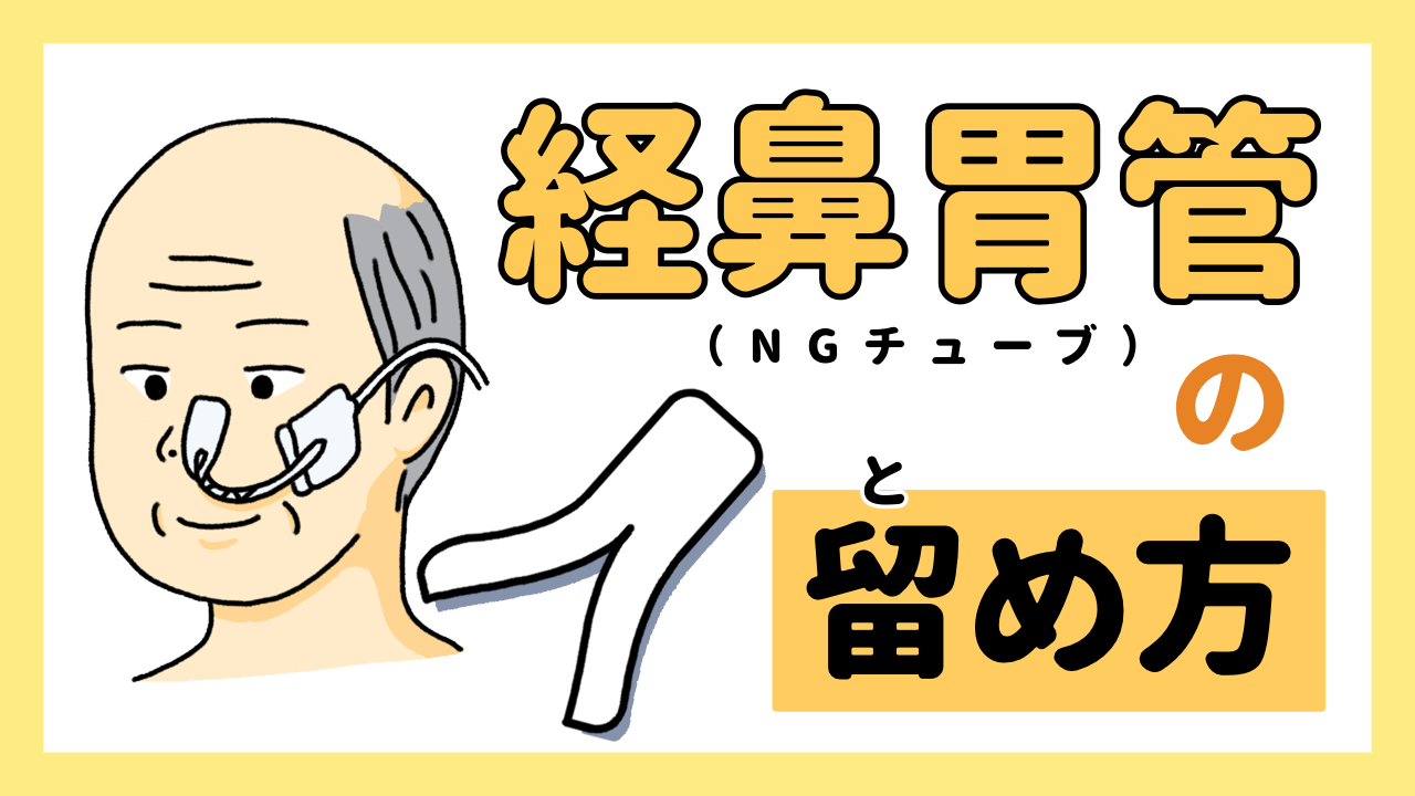 その固定、大丈夫？“抜けた・かぶれた”を防ぐ経鼻胃管固定の基本と工夫