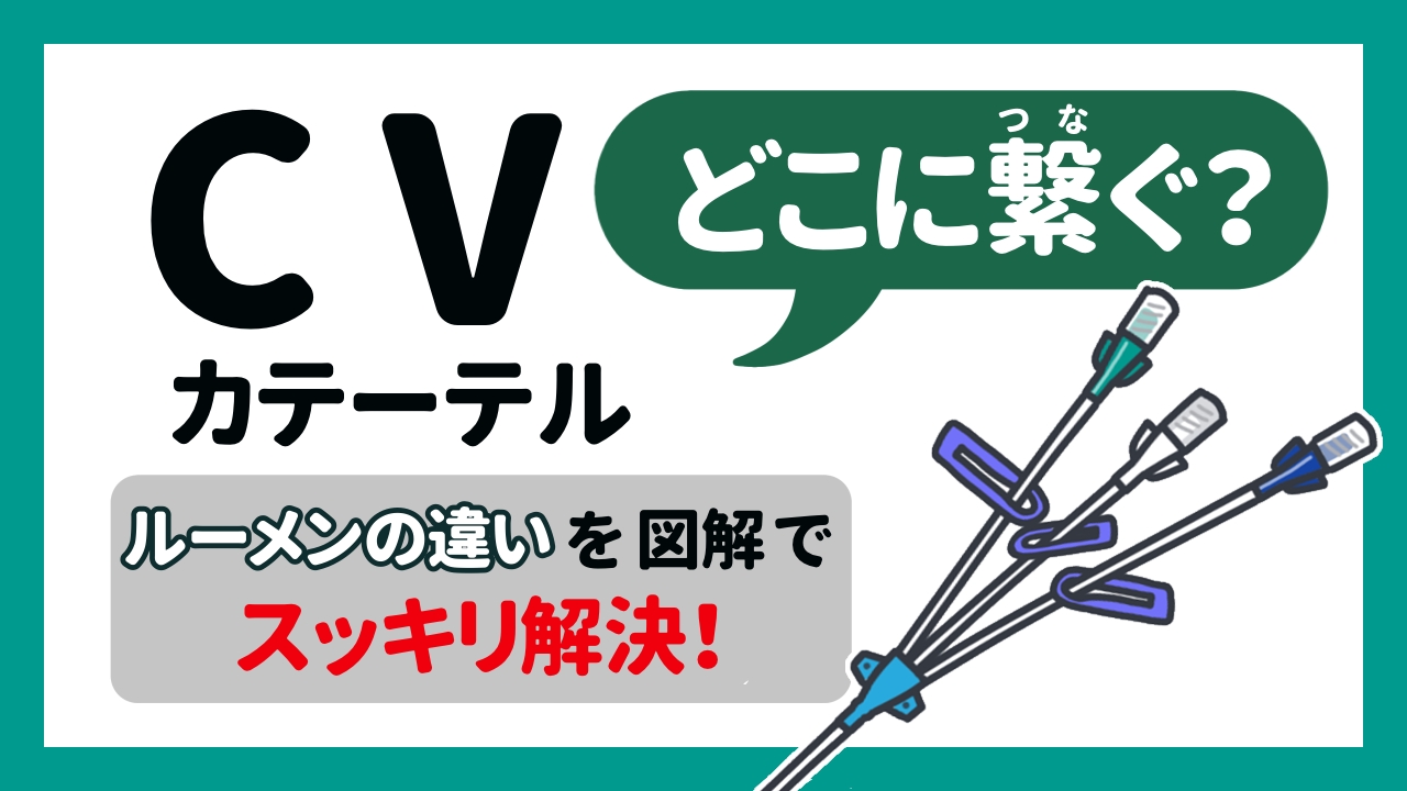 CVカテーテル（中心静脈カテーテル）どこに繋ぐ？ルーメンの違いを図解でスッキリ解説！