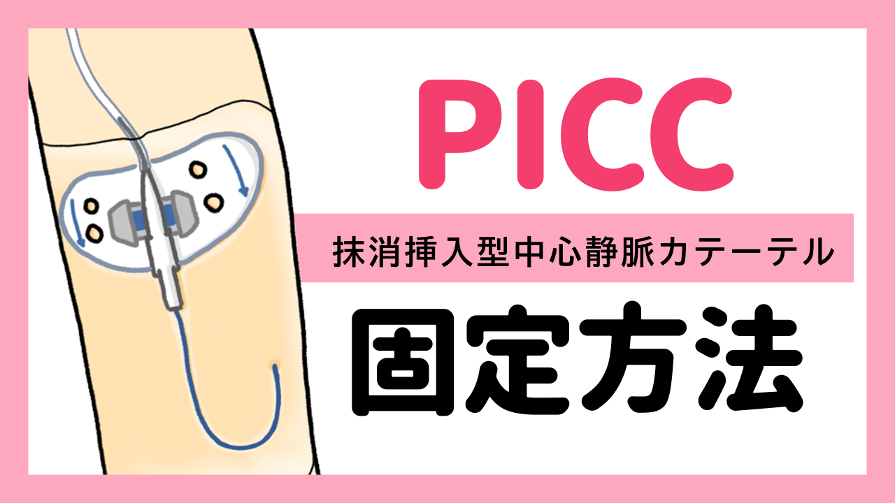 PICC（ピック）について〜固定方法〜