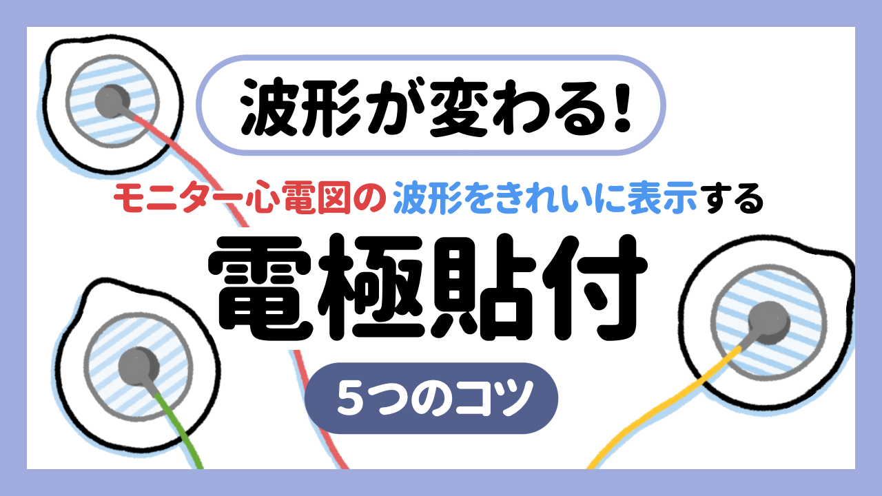 波形が変わる！モニター心電図の波形をきれいに表示する電極貼付の５つのコツ
