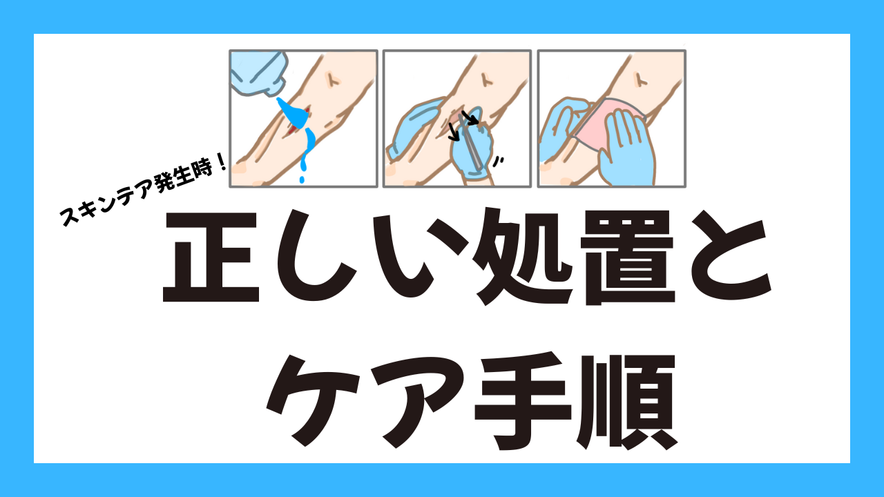 スキンテアが起きたら?!　スキンテア発生時の正しい処置とケア手順