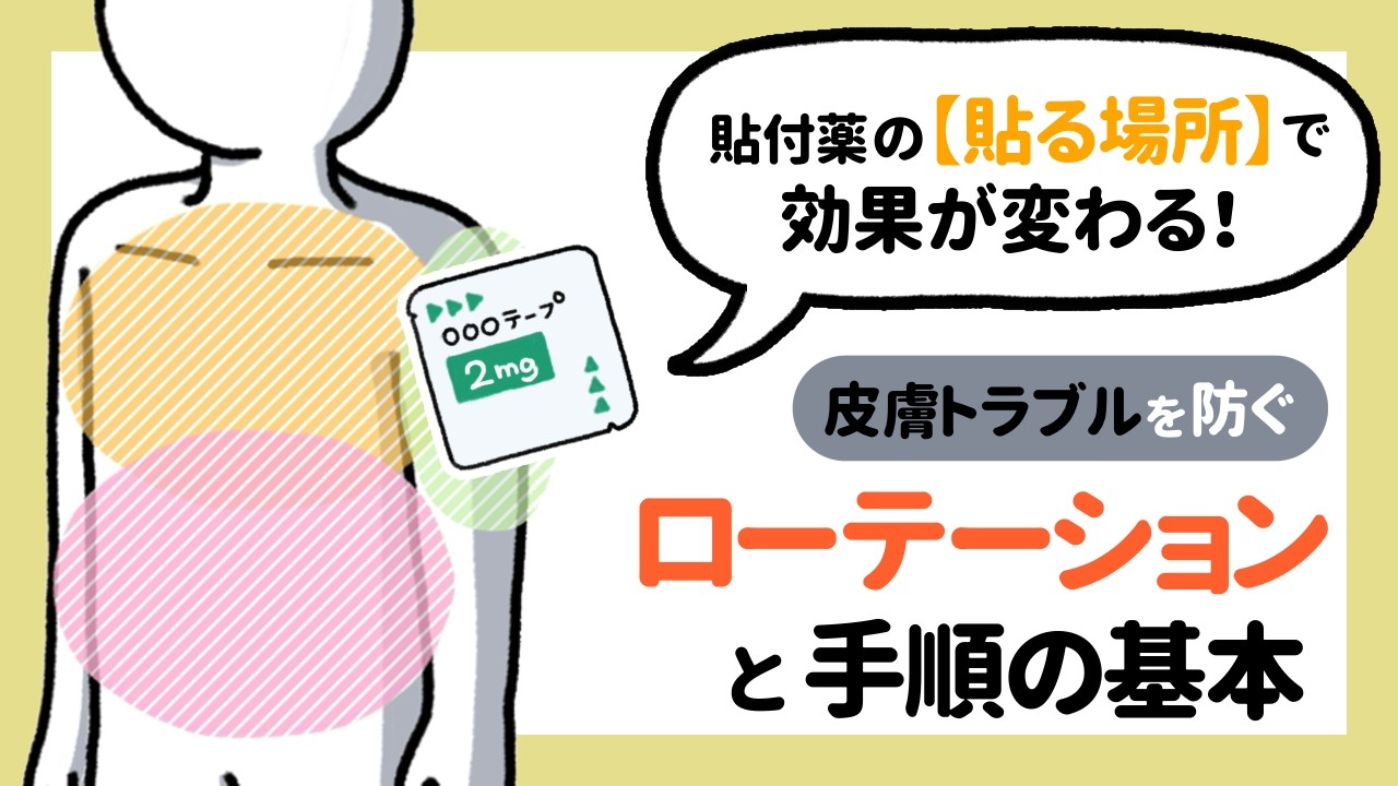 貼付薬の「貼る場所」で効果が変わる！皮膚トラブルを防ぐローテーションと手順の基本